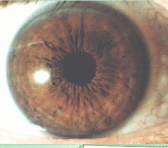 Vonk Natuurlijk Heamatogeen