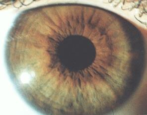 Vonk Natuurlijk Mengtype